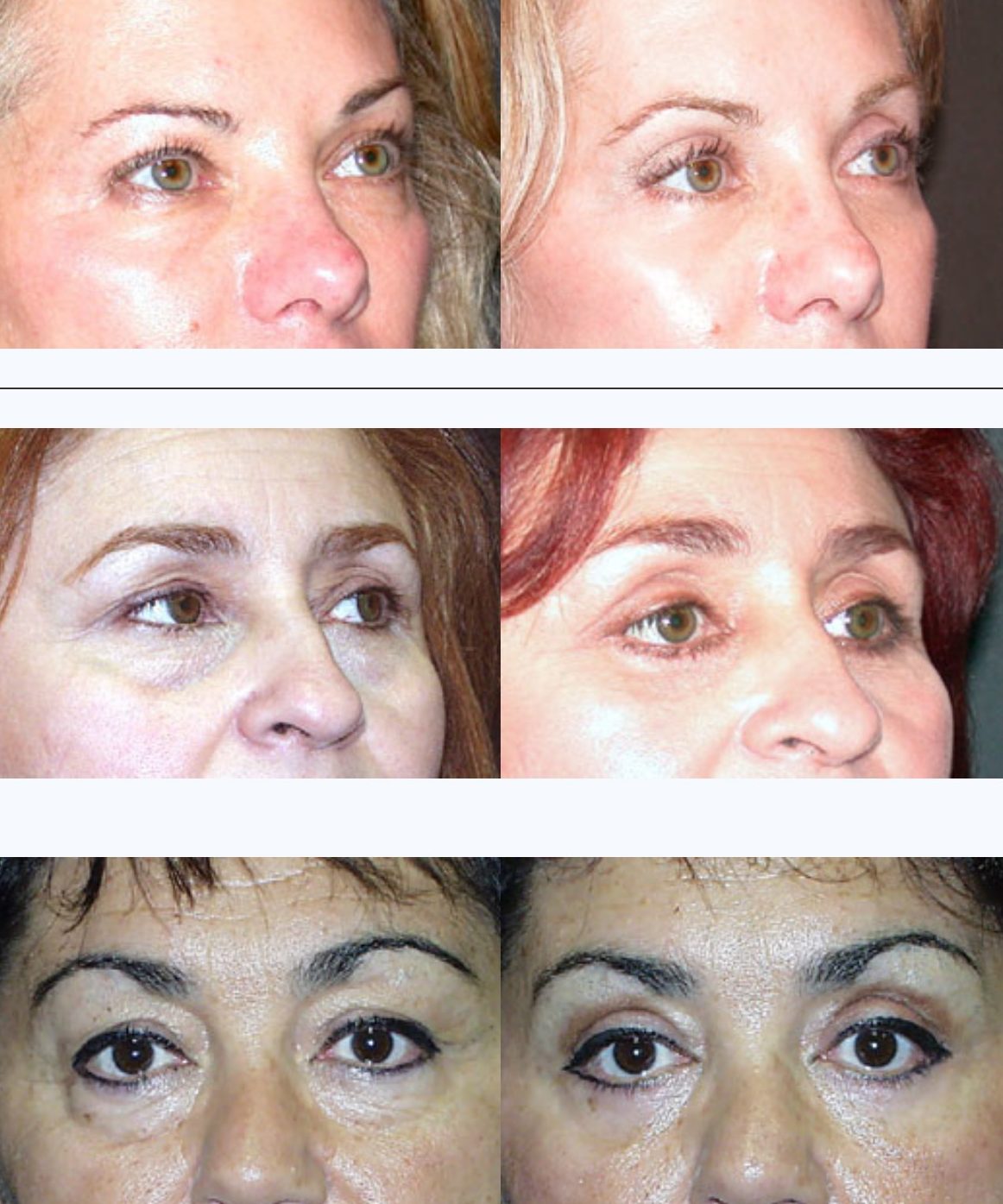 Ophthalmic Plastic and Facial Aesthetic Surgery Services