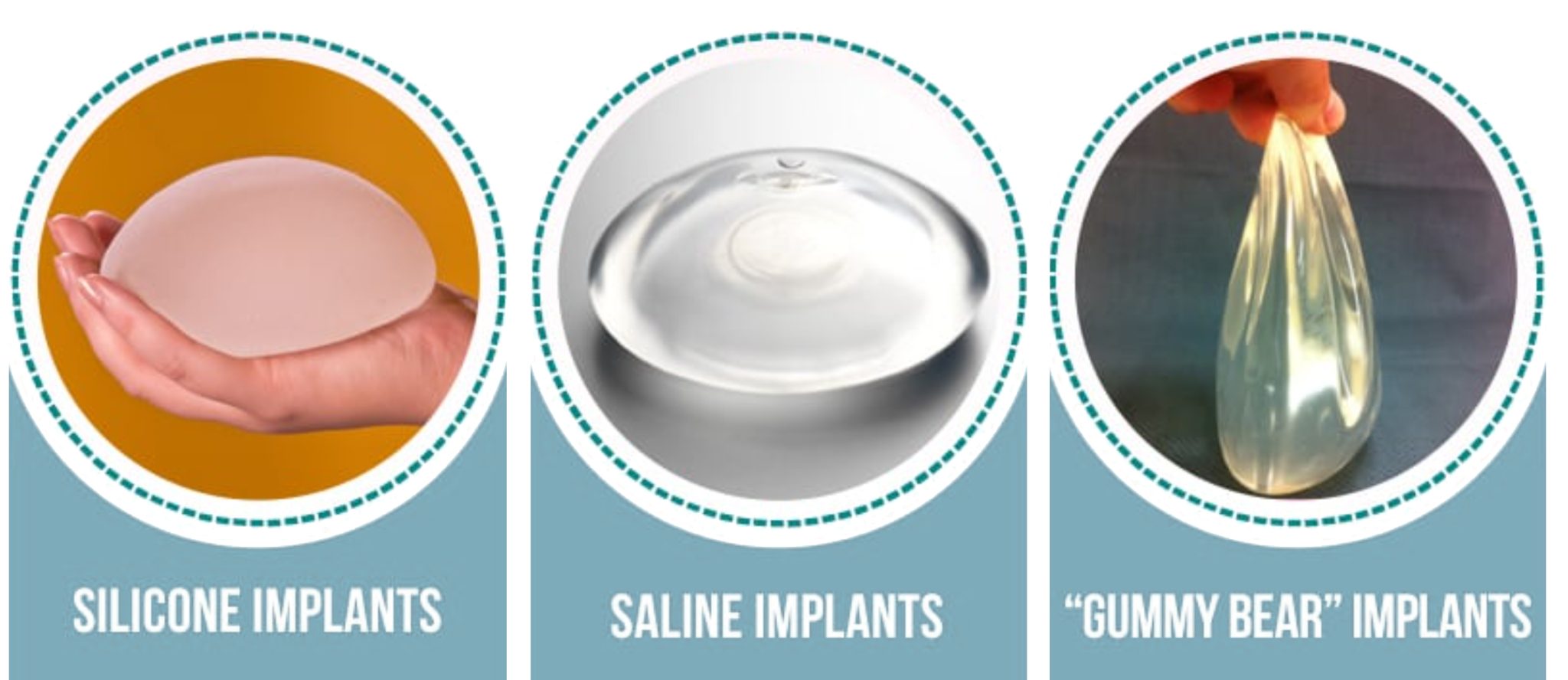 Best Breast Implants Saline, Silicone, Gummy Bear Orlando FL
